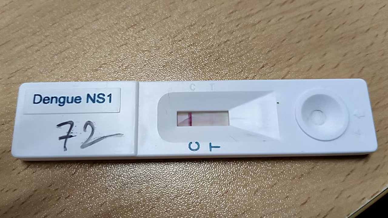 ডেঙ্গু শনাক্তের কিট