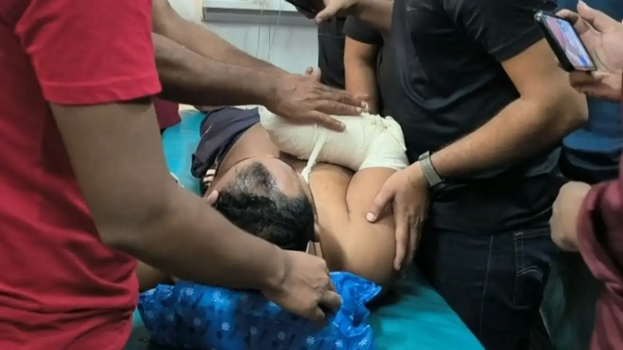 মাদারীপুরে পূর্ব শত্রুতার জেরে যুবকের হাতের কব্জি বিচ্ছিন্ন