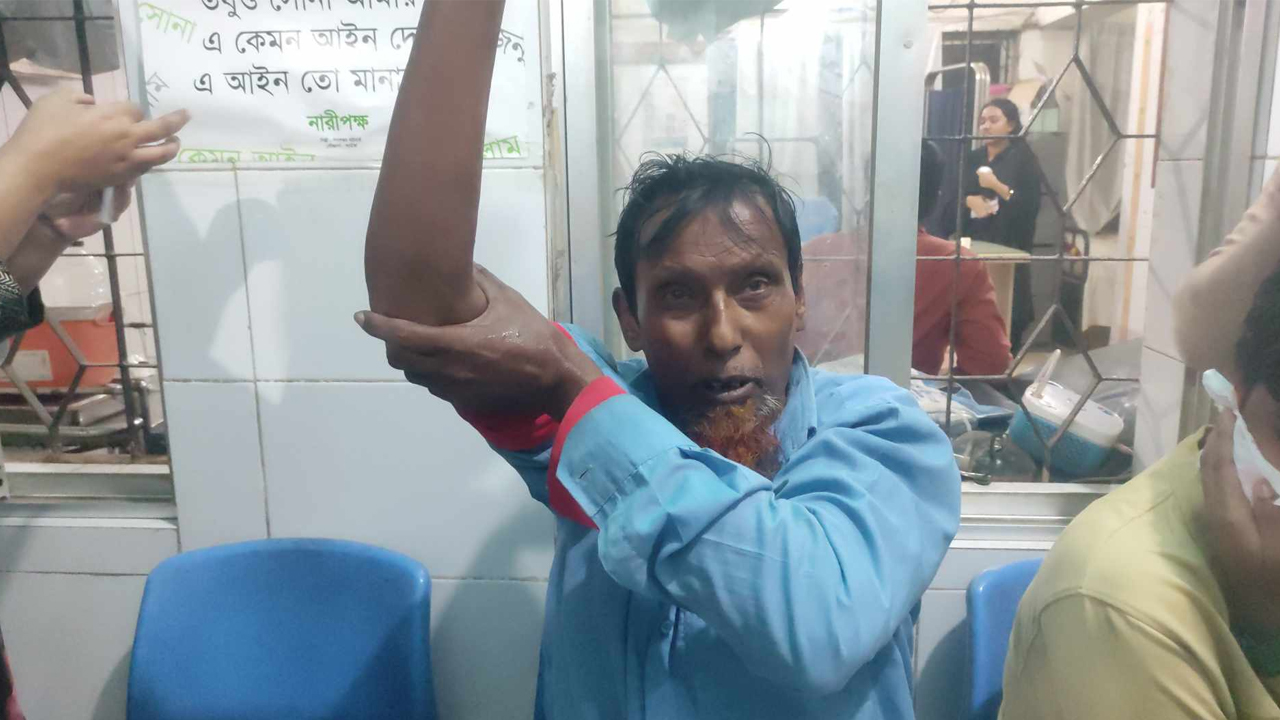 সাভারে পাগলা কুকুরের কামড়ে ৬৪ জন&zwnj; আহত