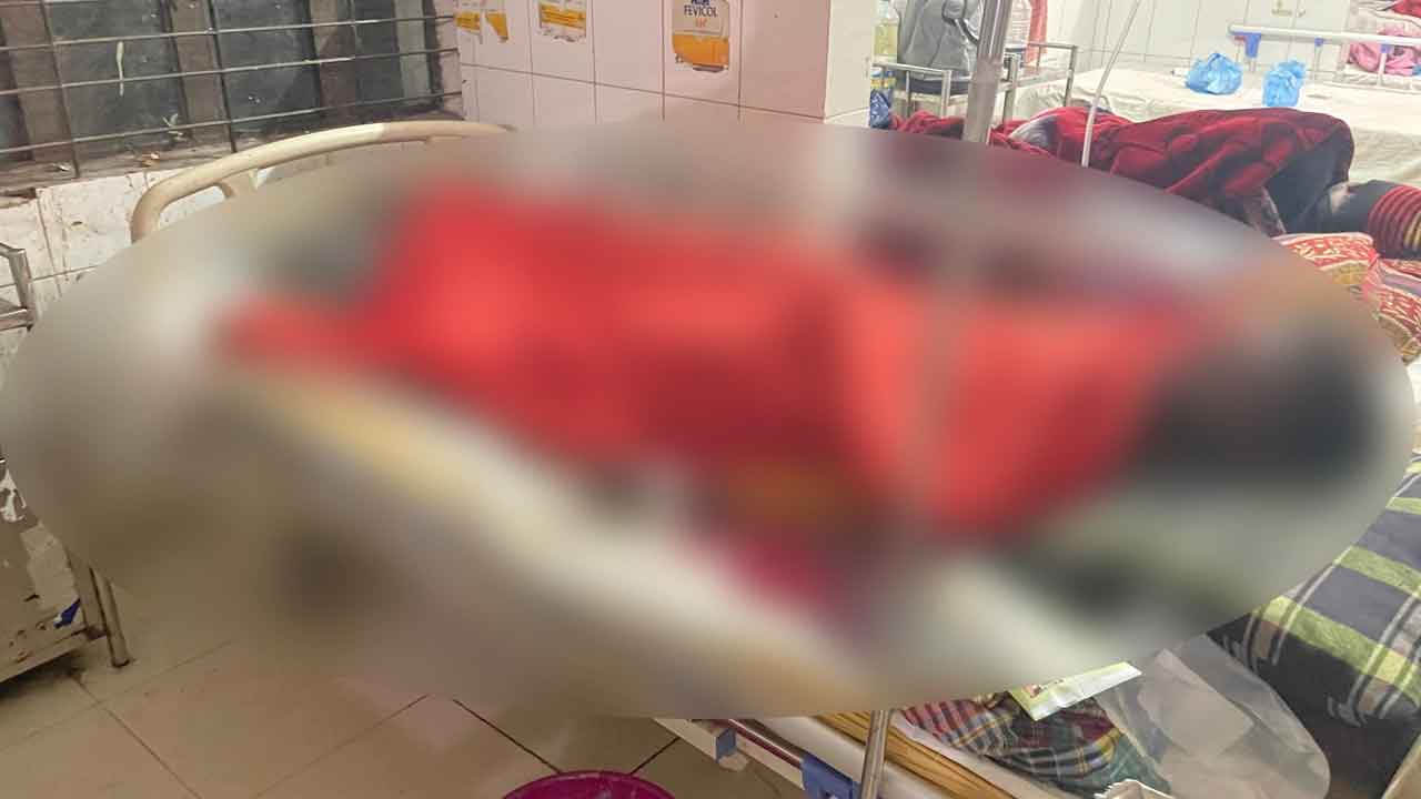 রাসেলস ভাইপার সাপসহ কৃষক হাসপাতালে