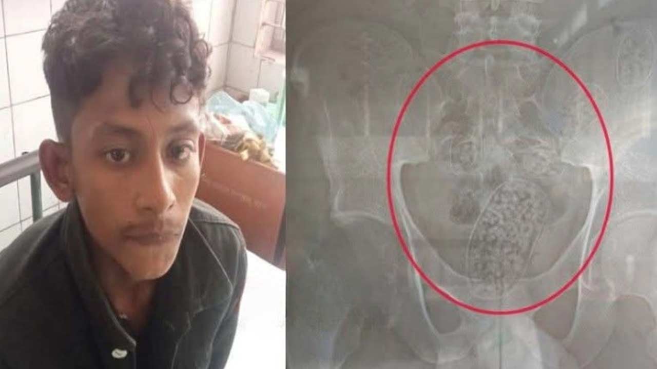 যশোরে পেটে বহন করা ইয়াবাসহ যুবক আটক