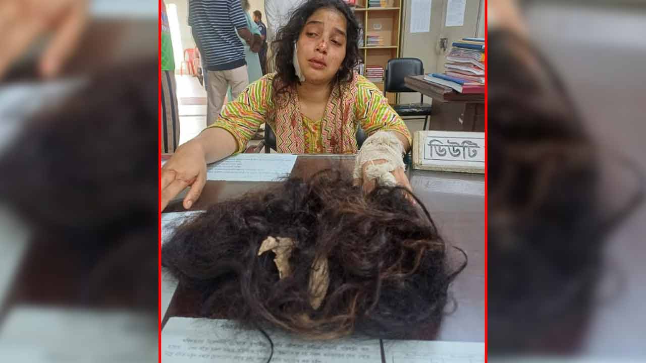 যৌতুকের দাবিতে স্ত্রীকে নির্যাতন, চুল কেটে দেওয়ার অভিযোগ স্বামীর বিরুদ্ধে