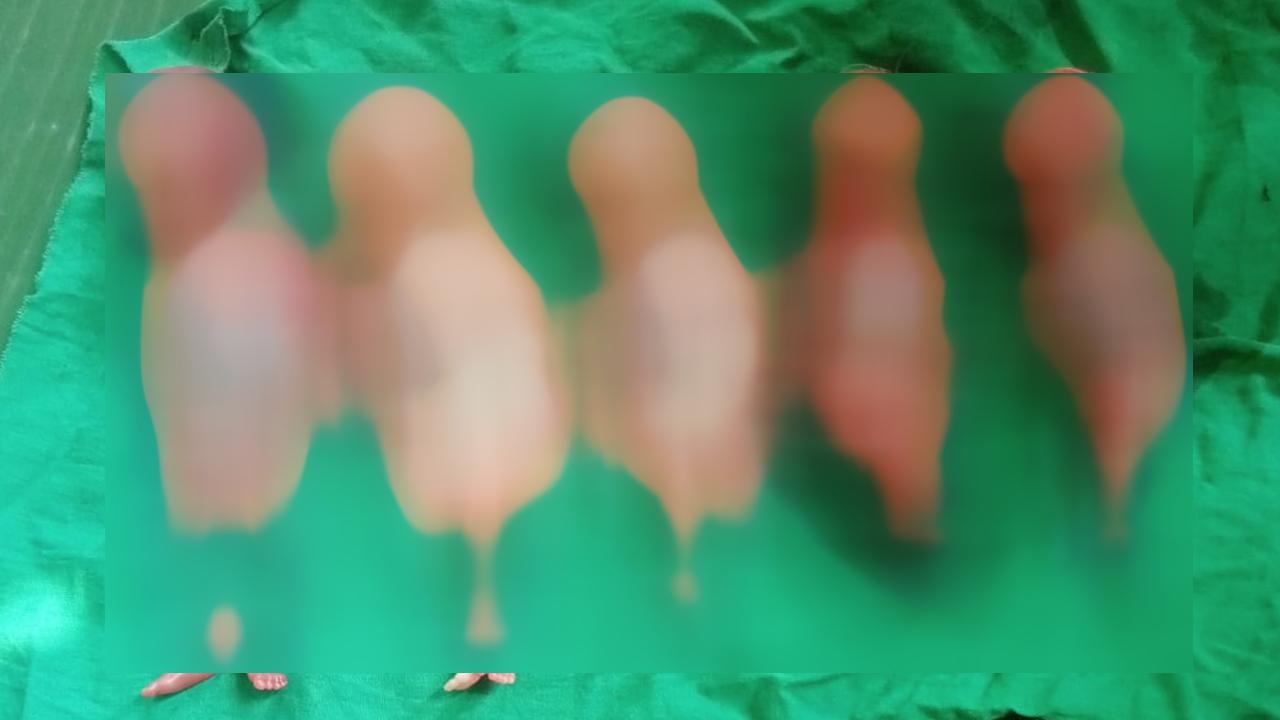 নড়াইলে এক মায়ের গর্ভে ৭ সন্তান, বাঁচল না কেউ