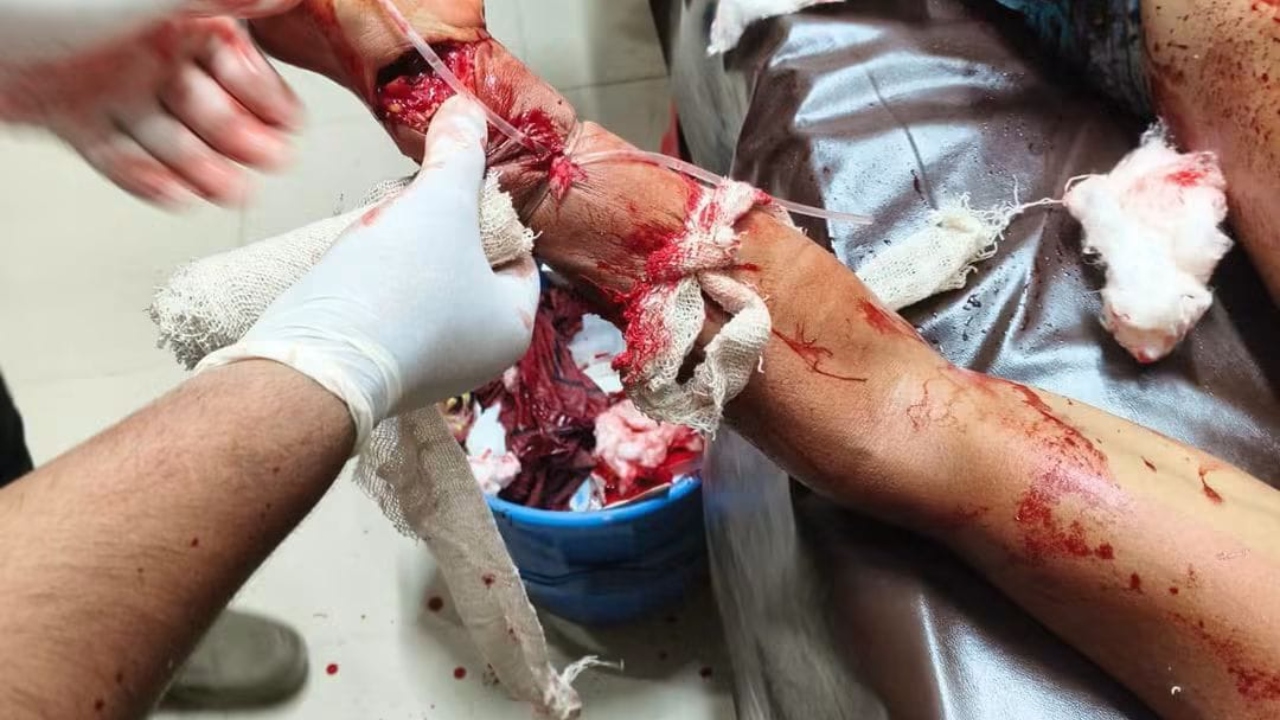জমির আইল কাটার বিরোধে যুবদল নেতার কব্জি কেটে দেওয়ার অভিযোগ, গ্রেপ্তার ২