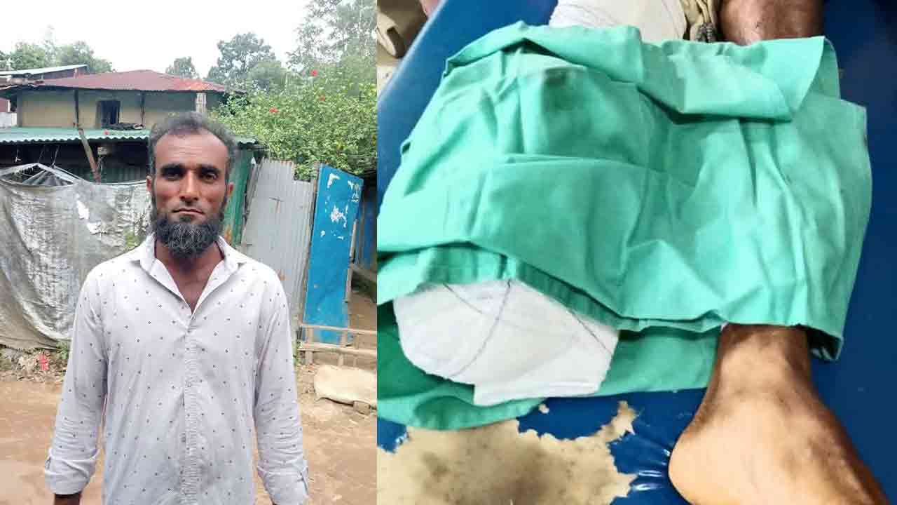 কক্সবাজারে মাইন বিস্ফোরণে যুবকের পায়ের গোড়ালি বিচ্ছিন্ন