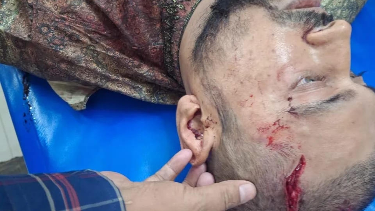 দাগনভূঞায় যুবককে কুপিয়ে জখম, গ্রেপ্তার ১