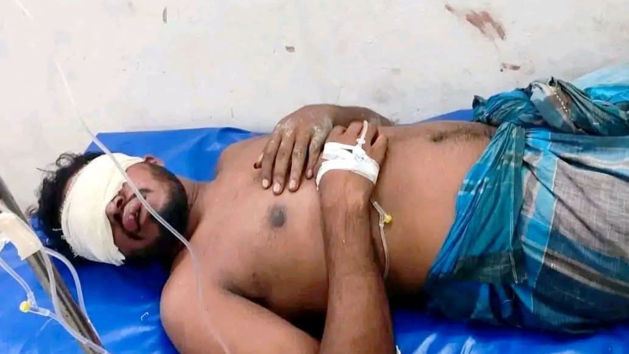 মাইক্রোবাসে তুলে যুবকের দুই চোখ উপড়ে ফেলার অভিযোগ, গ্রেপ্তার ১